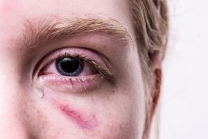 В Пензенской области отец десять раз изнасиловал свою 15-летнюю дочь