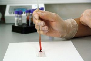 В Пензенской области заведующую поликлиникой осудили за подмену крови