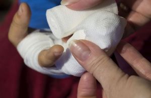 В Пензе выявили первых виновных в гибели 9-летнего мальчика от ожогов