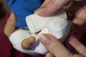 Около 700 человек обратились за помощью к пензенским травматологам