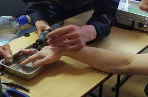 Пензенские спасатели помогли снять кольцо мужчине, получившему травму