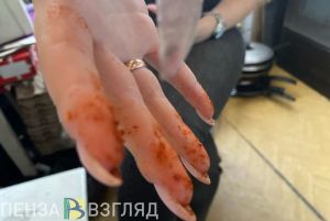 Зареченка на Рождество сделала мужу ножевой «подарок»