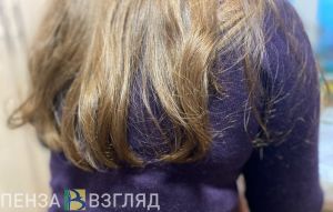 Встреча с бывшим закончилась для пензячки 14 швами на голове