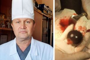 Тазобедренный сустав пензенца передали в музей мединститута