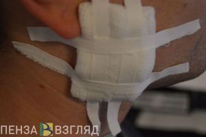 Пострадавшим пензенцам окажут первую медицинскую помощь по новым правилам