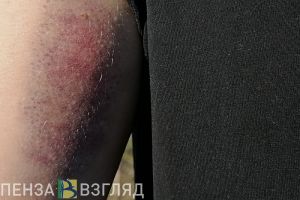 Жительница Лунинского района избила полицейского и грозила удушить его веревкой