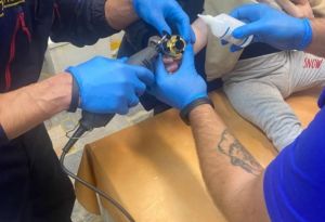 В Пензе оказали помощь ребенку, у которого палец застрял в замке