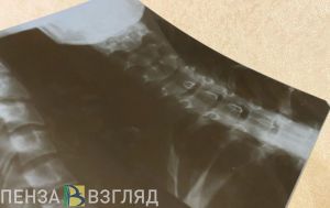 За 7 месяцев пензенцы получили высокотехнологичную медпомощь на 926 млн рублей