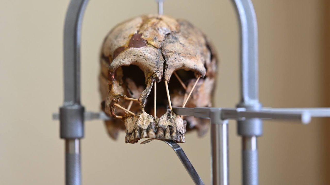 В Пензенской области нашли следы работы стоматолога II–IV веков нашей эры