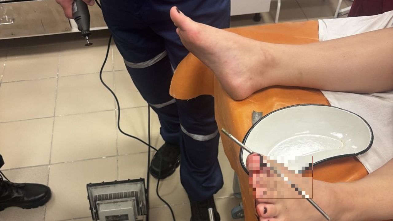 В Пензе девочке проткнуло ногу металлическим штырем