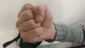 Одна фраза и один удар в баре Пензы обернулись госпитализацией и уголовным делом