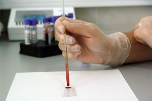 В Пензенской области завполиклиникой велела заменить кровь пьяного мужа, чтобы «отмазать» его от ответственности
