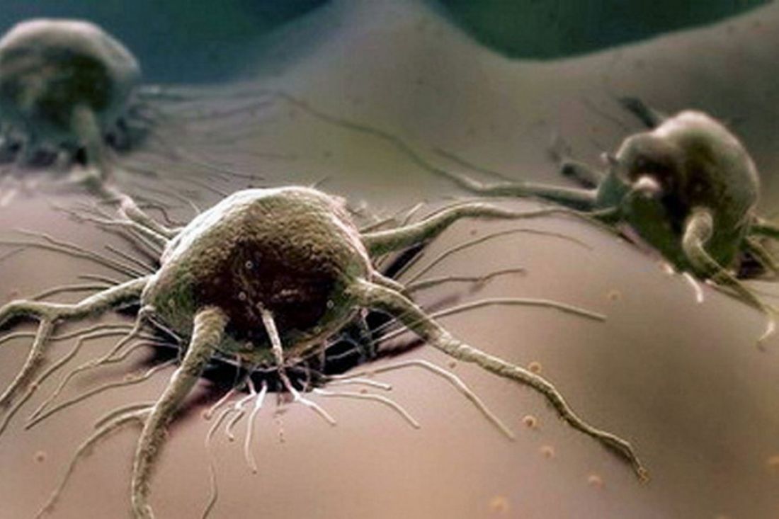 Онкологические клетки. Описание болезни описание болезни. Что может вызвать онкологию. Международный день онколога. Онкологические заболевания заразные ?.