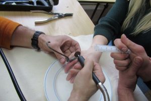 Пензячке пришлось вызвать спасателей, чтобы снять кольцо с пальца